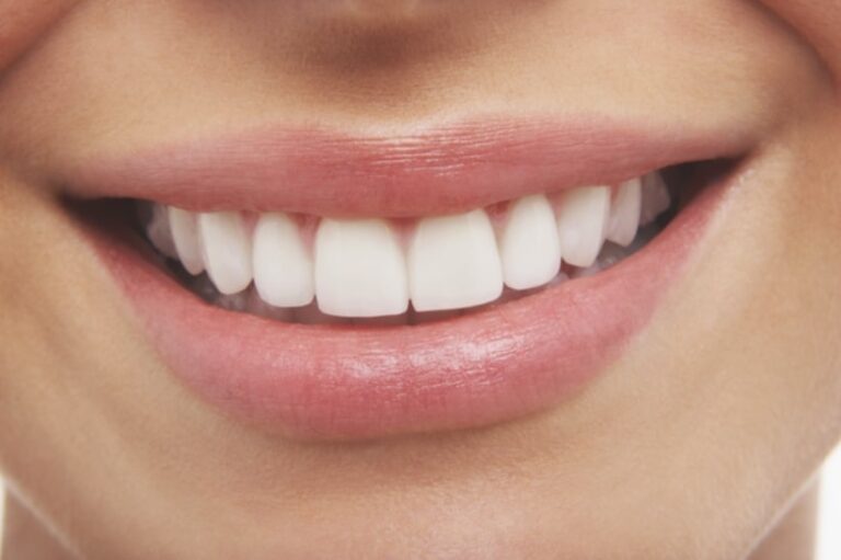 Comment avoir les dents blanches avec des produits naturels